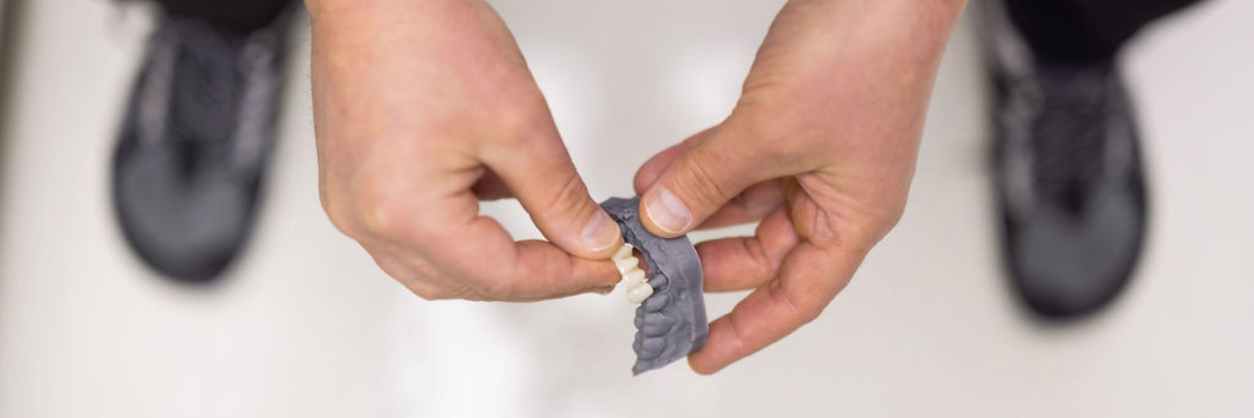 Crowns and Bridges | Dentist